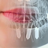 Specialist in all on four treatments